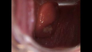 Avy Abre el Coño con Espéculo